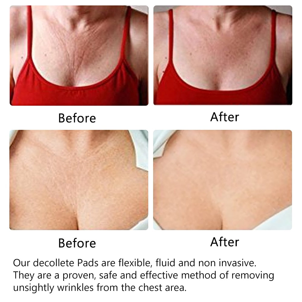 Reusable Anti Wrinkle Sticker for Neck Breast Chest Forehead Anti