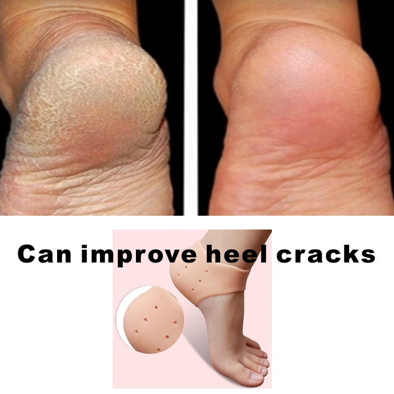 Heel Callus Cracked heels - Podantics Podiatry Adelaide